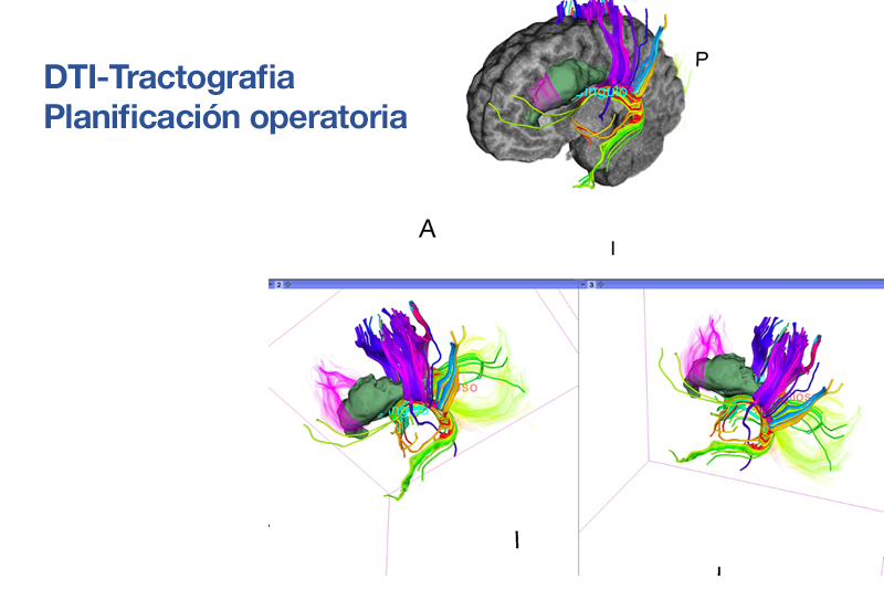 Neuroimagenes