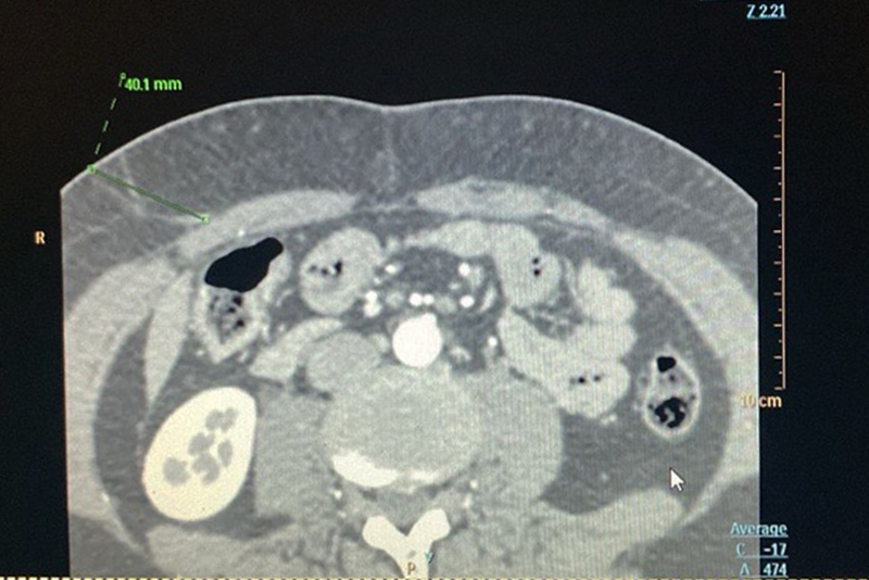 Imágenes Diagnósticas del Country