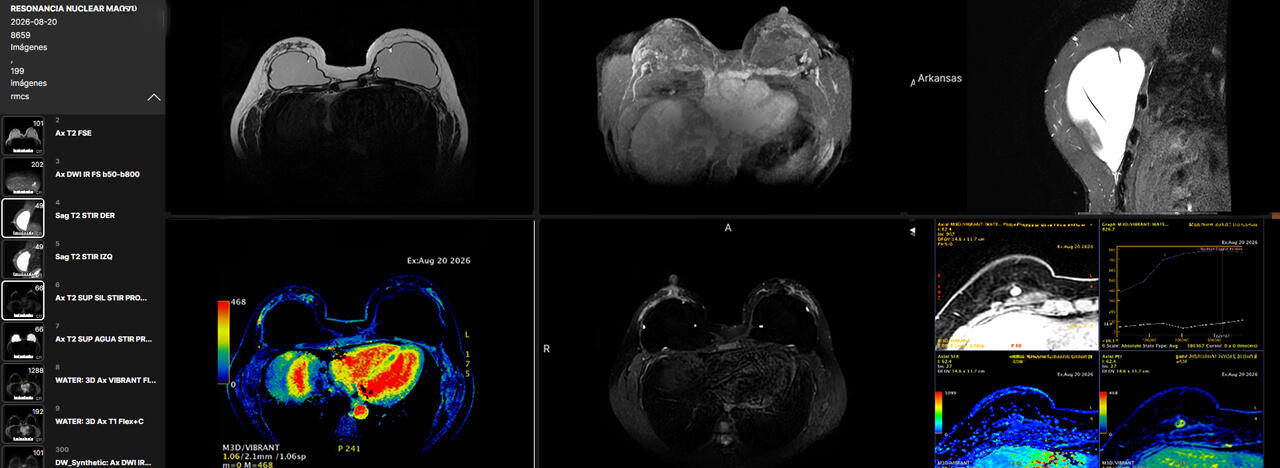 En oncología, el tiempo es tan importante como la oportunidad de una imagen